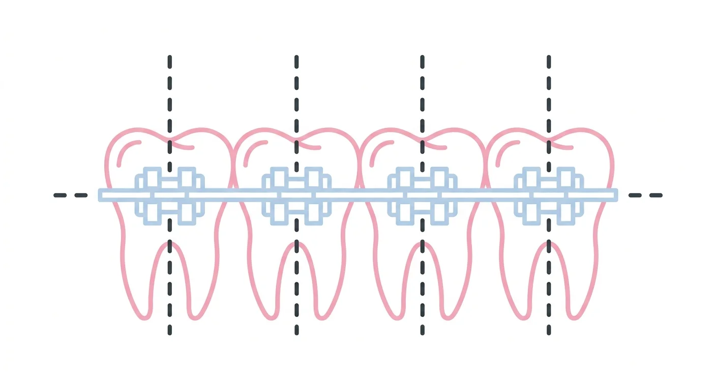 Brackets estéticos autoligado